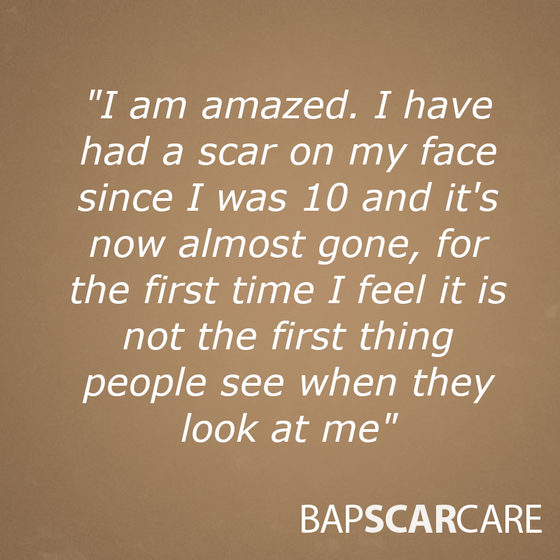 BAPScarCare's tweet photo. 💜⭐️⭐️⭐️⭐️⭐️💜

https://t.co/mv72kCCUQZ

#WednesdayMotivation #scar #scartreatment #skincare #Review https://t.co/CBHWW1U4IK