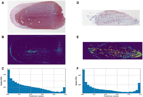 Artificial intelligence does as well as humans in predicting final pathology on thyroid fine needle aspiration biopsies bit.ly/2GPQ9sq <a href="/DrRange1/">DanielleElliottRange</a> <a href="/DukePathDept/">DukePathDept</a> #DukeML
