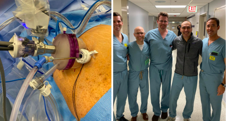 SimoneCrivella2's tweet photo. Today 20th #SP observation and training day at #UIC with Dr Jeff Yoshida, Dr Jeffrey Bassett and Dr Robert Torrey from Newport Urology Oncology (Southern California). We performed #SP robotic ureteroplasty with buccal mucosa graft. #floatingdock #sidecartrocar #singleincision. https://t.co/lHSPDZn1Vk