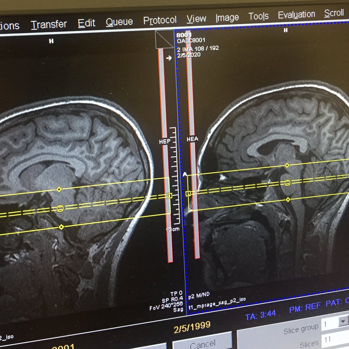 ANDLabVT's tweet image. Let&apos;s mark the spot. Today at VTCRC