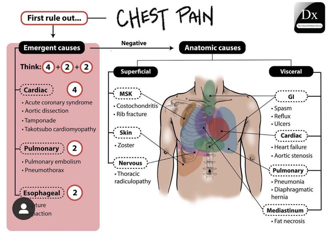 Chest Pain differential diagnosis. 