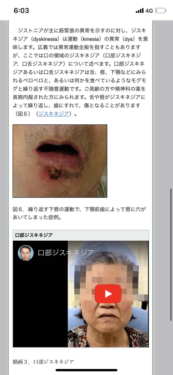 野村俊一 ジストニア 病院情報 ジストニアの診療 が可能と思われる病院 T Co Usylpkydga 患者さんの声 複数の患者会や専門医から聞いたが 精神病院で長期連用で重症化した ジスキネジア 患者さんが必要な治療をされないまま置き去りにされて