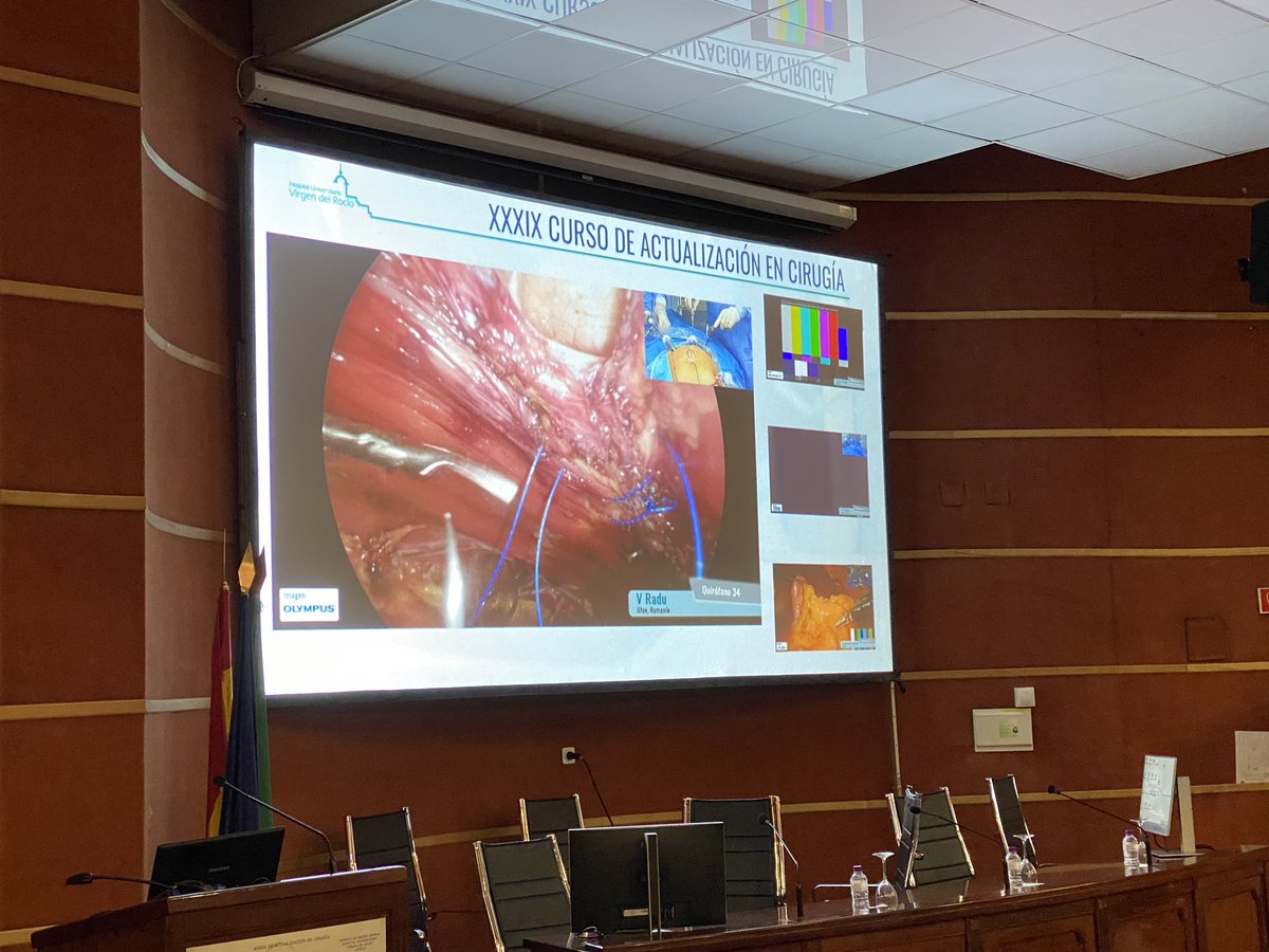 Seccion Pared AEC (@aecpared) on Twitter photo <a href="/drVictorRadu/">Victor Radu</a> in Seville 2020 Laparoscopy in abdominal wall: e-Tep. Great intervention. #herniafriends <a href="/AecPared/">Seccion Pared AEC</a> <a href="/eurohernias/">European Hernia Society</a> <a href="/scmi_itec/">aec_cmi</a> <a href="/drVictorRadu/">Victor Radu</a> in Seville 2020 Laparoscopy in abdominal wall: e-Tep. Great intervention. #herniafriends <a href="/AecPared/">Seccion Pared AEC</a> <a href="/eurohernias/">European Hernia Society</a> <a href="/scmi_itec/">aec_cmi</a>