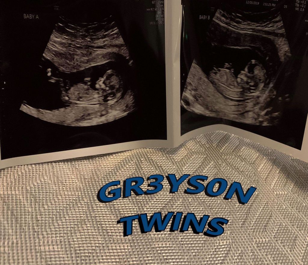 DirectAccessent's tweet image. Gr3ysOn Pulls On Heartstrings In “Twins” (Audio) directaccessworldwidemag.com/gr3yson-pulls-…