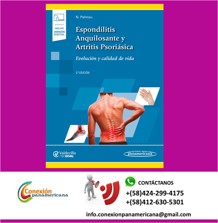 💢ESPONDILITIS ANQUILOSANTE Y ARTRITIS PSORIÁSICA 
⠀
👉 Solicítalo ya! 
🔸 Contáctanos e indica tu país de residencia⠀⠀⠀
.⠀⠀⠀
✔️ info.conexionpanamericana@gmail.com 
✔️ Whatsapp +584242994175 / +584126305301 ⠀⠀⠀⠀
✔️ Síguenos #conexionpanamericana