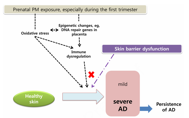 JACIInPractice's tweet image. In Press! #Prenatal #particulate #matter exposure with #skin #barrier dysfunction affects offspring’s #atopic #dermatitis: #COCOA study buff.ly/2OtErIn