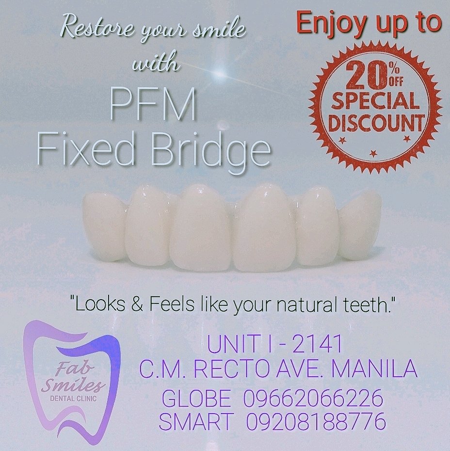 FabSmiles2141's tweet image. DM us for inquiries. 
#fabsmiles #fixedbridge 
#dentalcare