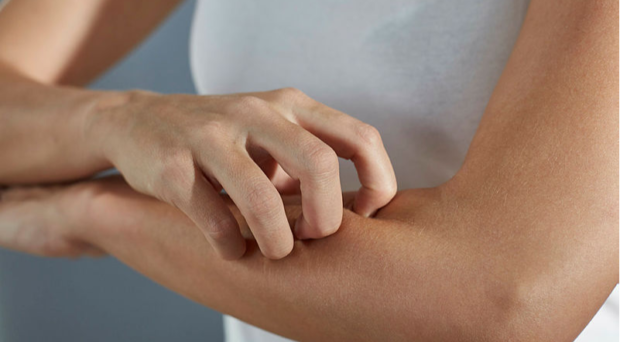 keyhvac's tweet photo. #Winterweather and cold air are a recipe for dry skin. You could manage your #dryskin with excessive amounts of moisturizer, or you could add a whole home #humidificationsystem . We can help with the latter. https://t.co/qoWWl5u2rt