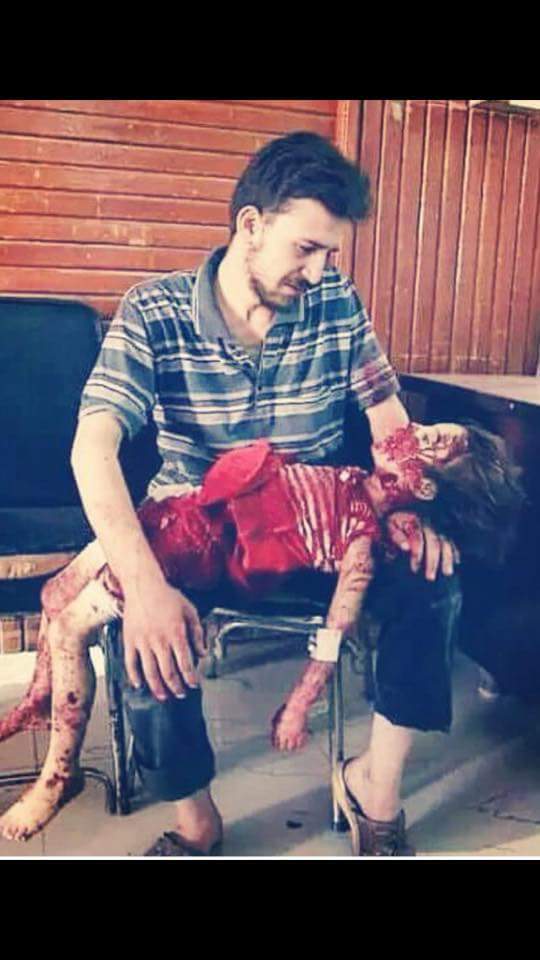 sungmanitu2020's tweet photo. #Syria9YearsOn #HowManyMore of #SyriasChildren deaths will bring #Justice &amp; an #Endbashar ?! 
#WhatDoesItTake ?! https://t.co/OKtVV0QChD