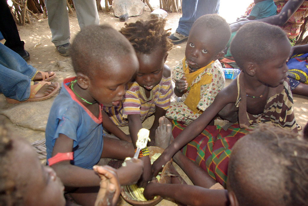 Дети в африке голодают