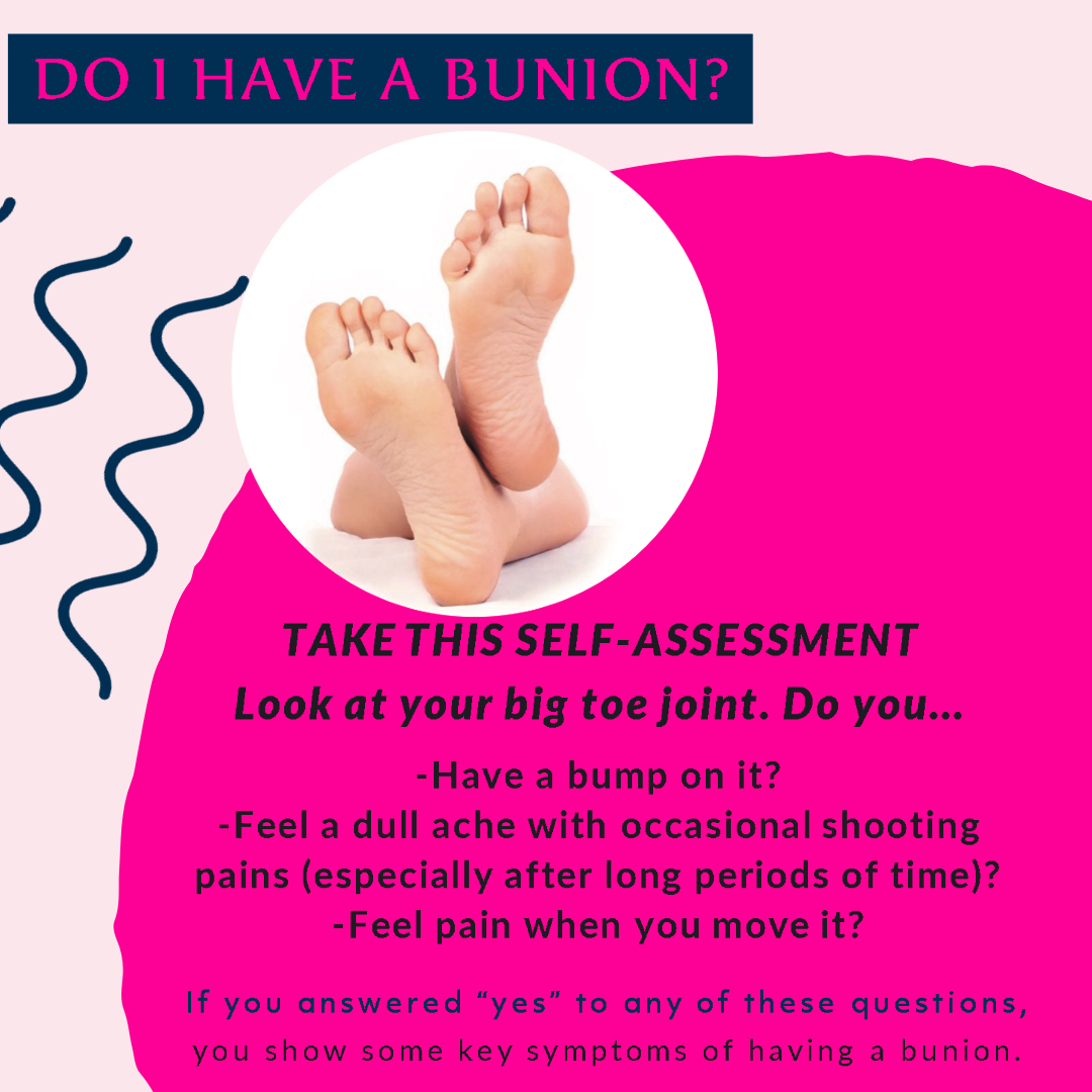 Yorkshire_Foot's tweet photo. Take the test #Bunion 👣
#footpain #footcare  #feet #foothealth #foot #podiatry #podiatrist #flatfeet #painrelief  #footpainrelief #corns #archsupport #footproblems #bunions  #toes  #anklesprain  #Leeds https://t.co/NaSiXUGqAs