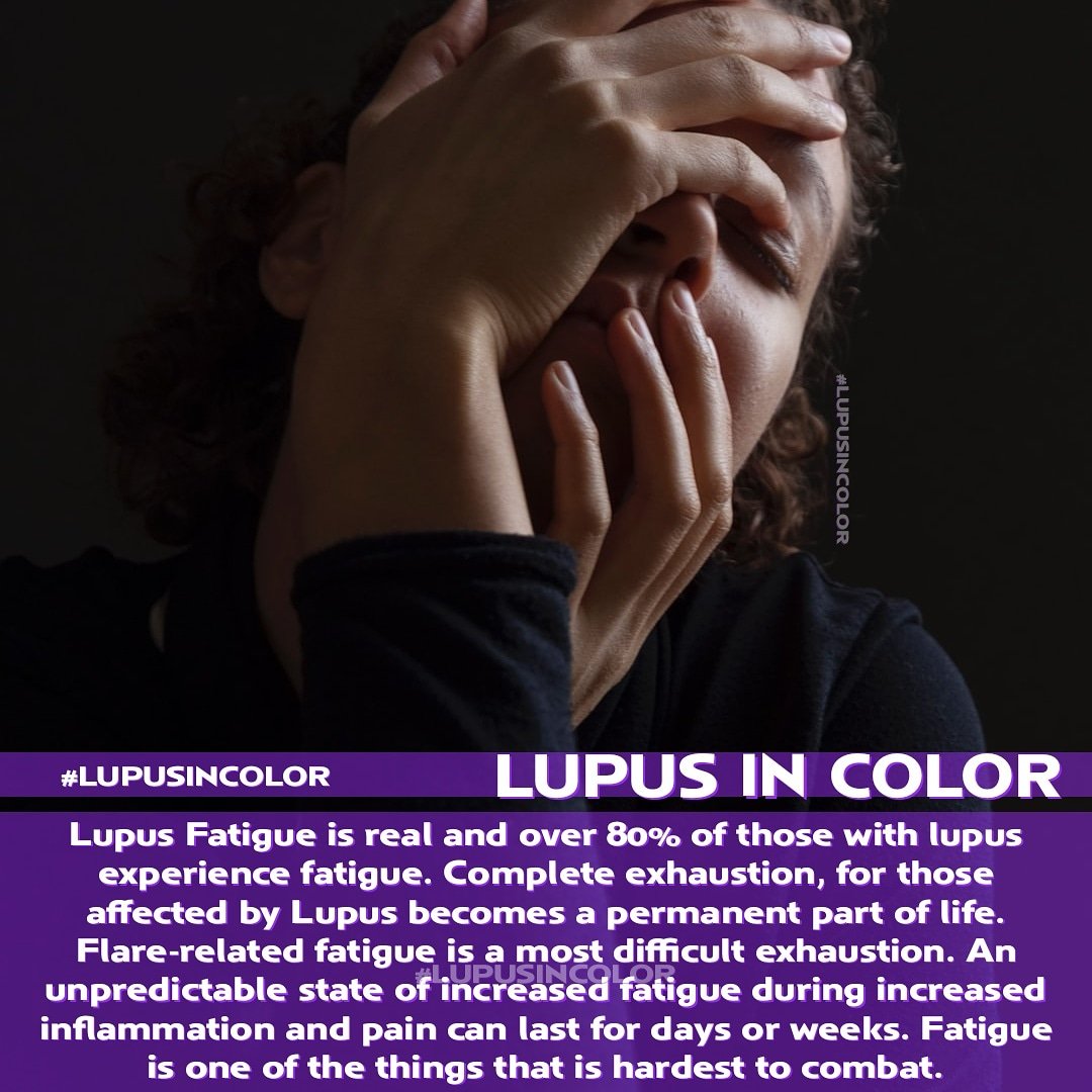 Lupus In Color on Twitter "Lupus Fatigue is real and over 80 of those
