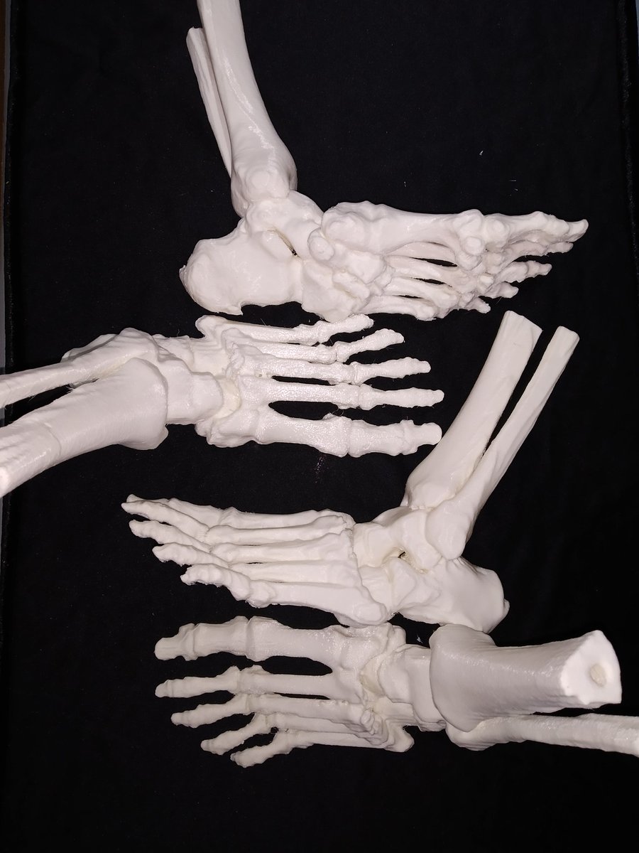 MM3D_'s tweet photo. Modelo3d para curso personalizado!
#3dmodel #3dprinting #custom3dmodel #bones #impresion3d #traumatologia https://t.co/GNGExR7QLe
