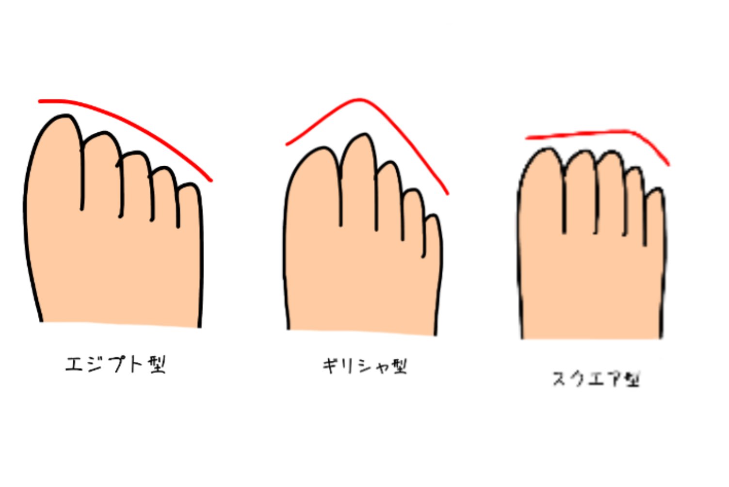 中北貴之 あなたの足の形はどれですか ちなみに 外反母趾になりやすいのは エジプト型 の足の人 エジプト型の人は つま先部分が細くなっている靴を履くと母趾が圧迫されるので そのような靴は選ばないようにした方が良いですね 外反母趾 靴の