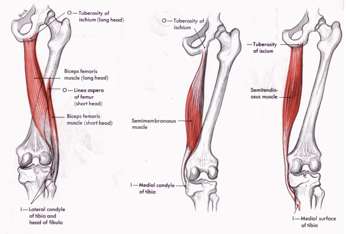 EverythingTF's tweet photo. New Thoughts on Hamstring Training
@mboyle1959
What's the best way to prevent hamstring injury?
How can we best train the posterior chain?
What works best?
What's most functional? What's least?
https://t.co/x1lxnX64pi
#hamstrings #trackandfield #mfathletic #mikeboyle https://t.co/tJcvJOojcC