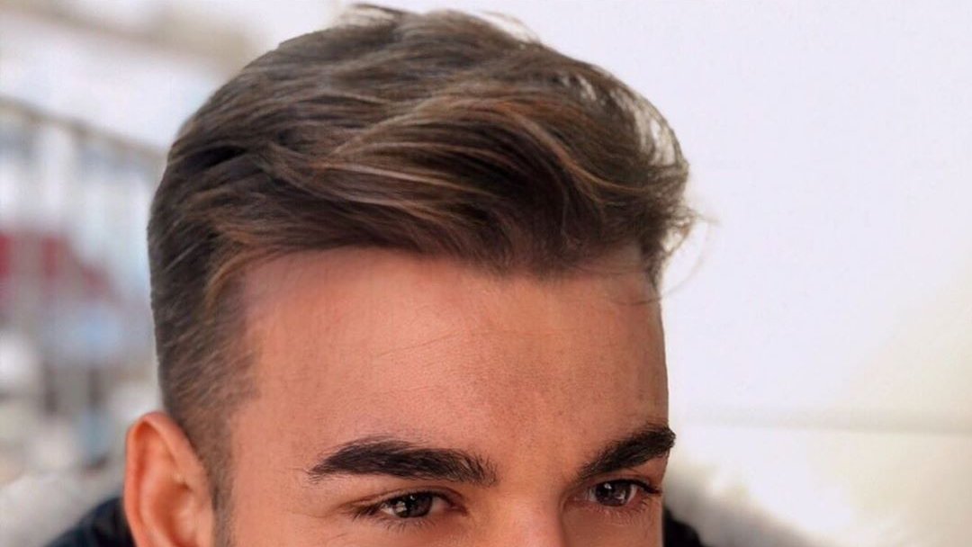 Sanantur_'s tweet photo. Resultados espectaculares de nuestros clientes 😎
Sí, ¡puedes recuperar tu pelazo! El injerto capilar es una de las mejores soluciones actualmente para cubrir las zonas más despobladas del cabello.

Infórmate sin compromiso: https://t.co/ahdCPlNNWY https://t.co/RJRfanX0Em