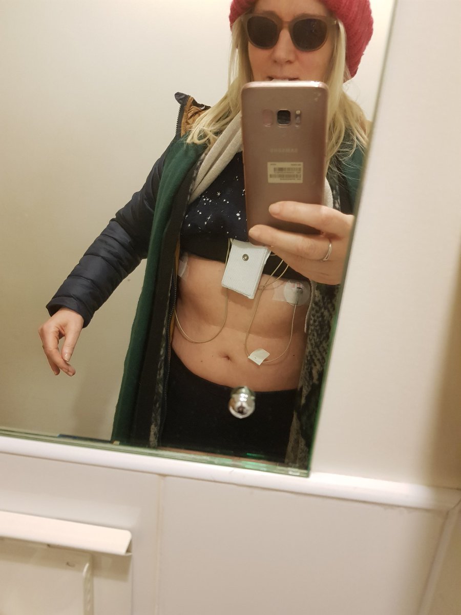 A1LondonLady's tweet photo. Caught in a catch 22 need to exercise cos osteoporosis but cant cos Cancer Drug #Aromasin causing heart problems,more Early Breast Cancer deaths from heart related issues than the Cancer😜 https://t.co/ZGaNks5FyQ