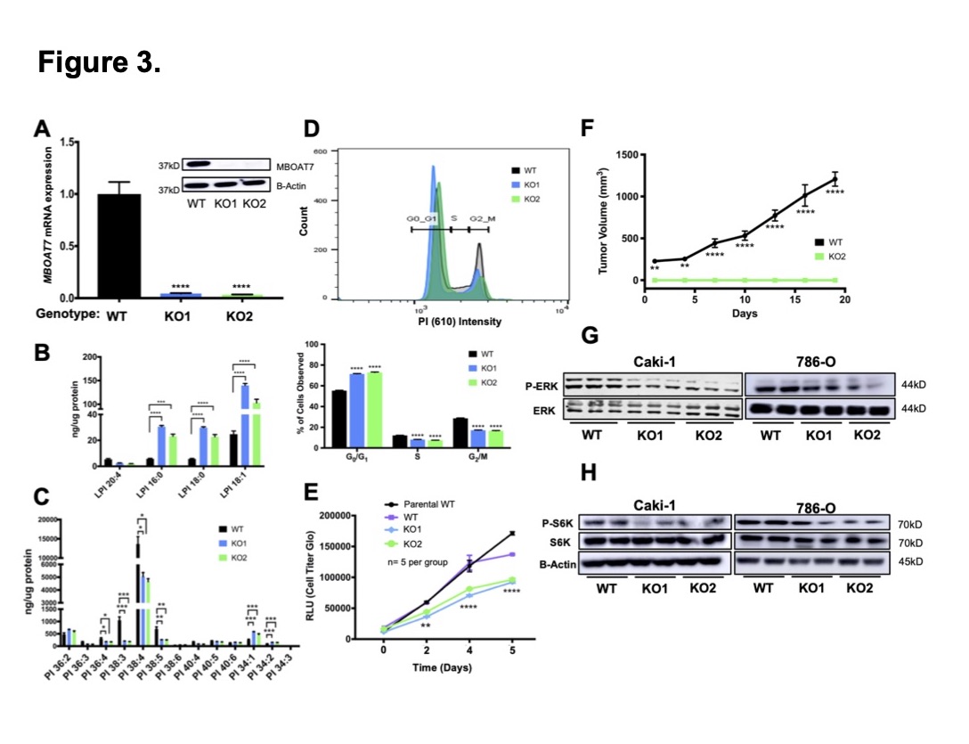 MolMetab's tweet photo. Data revealing that #metastatic #ccRCC is associated with altered AA-PI #metabolism, and identify #MBOAT7 as a novel target in advanced ccRCC.
https://t.co/PEO4a1sTje
#carcinoma #lipid #phosphatidylinositol https://t.co/nog4OrVvAB