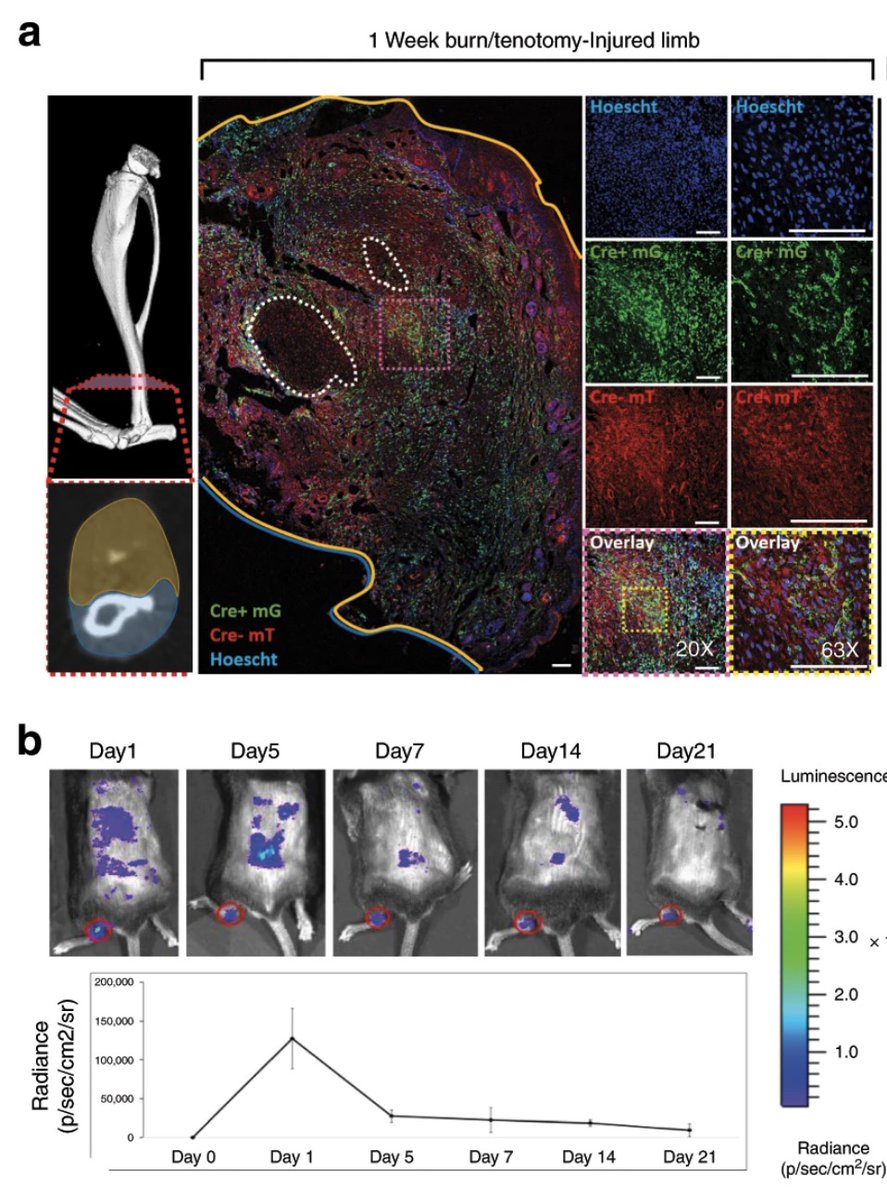 GIRCOR's tweet image. #Os🦴: l'#ossification anormale d'un muscle, tendon ou ligament peut survenir après un traumatisme ou une brûlure. Sur modèle #souris🐁 on découvre le mécanisme de ce phénomène. L'activation du peptide CD47 serait une voie thérapeutique😮😊👍 nature.com/articles/s4146…