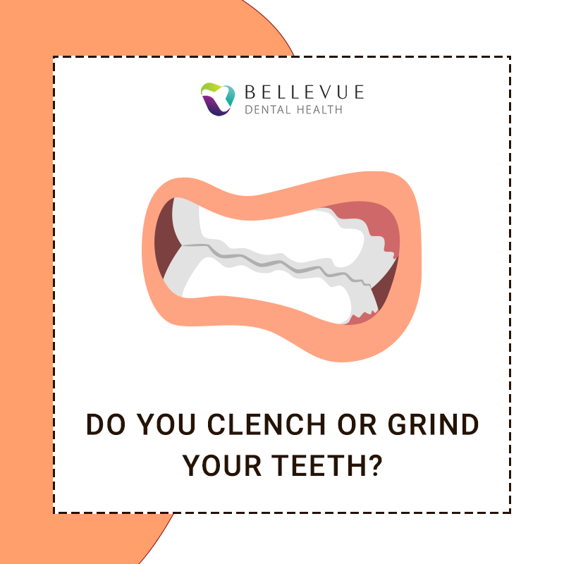 DrLibbiFinnessy's tweet photo. If you think you have frequent jaw pain, morning headaches, snoring problems, talk to our cosmetic dentist Dr. Libbi Finnessy at Bellevue Dental for more information, or call us at (425) 641-3311 to schedule an appointment.
#smiles #dentistry #bellevuedentalhealth https://t.co/NufyLB87MA