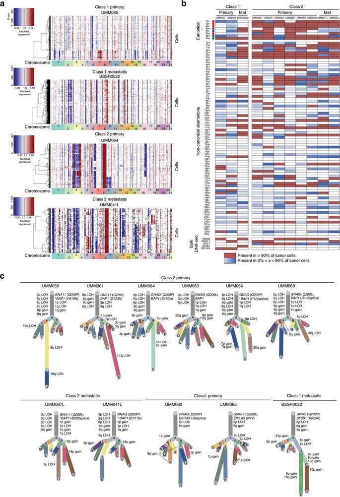 Single cell copy-number variation analysis of primary and metastatic uveal melanomas.

Ref: go.nature.com/2RJ0WuN

#singlecell #scRNAseq #uvealmelanoma #copynumbervariation