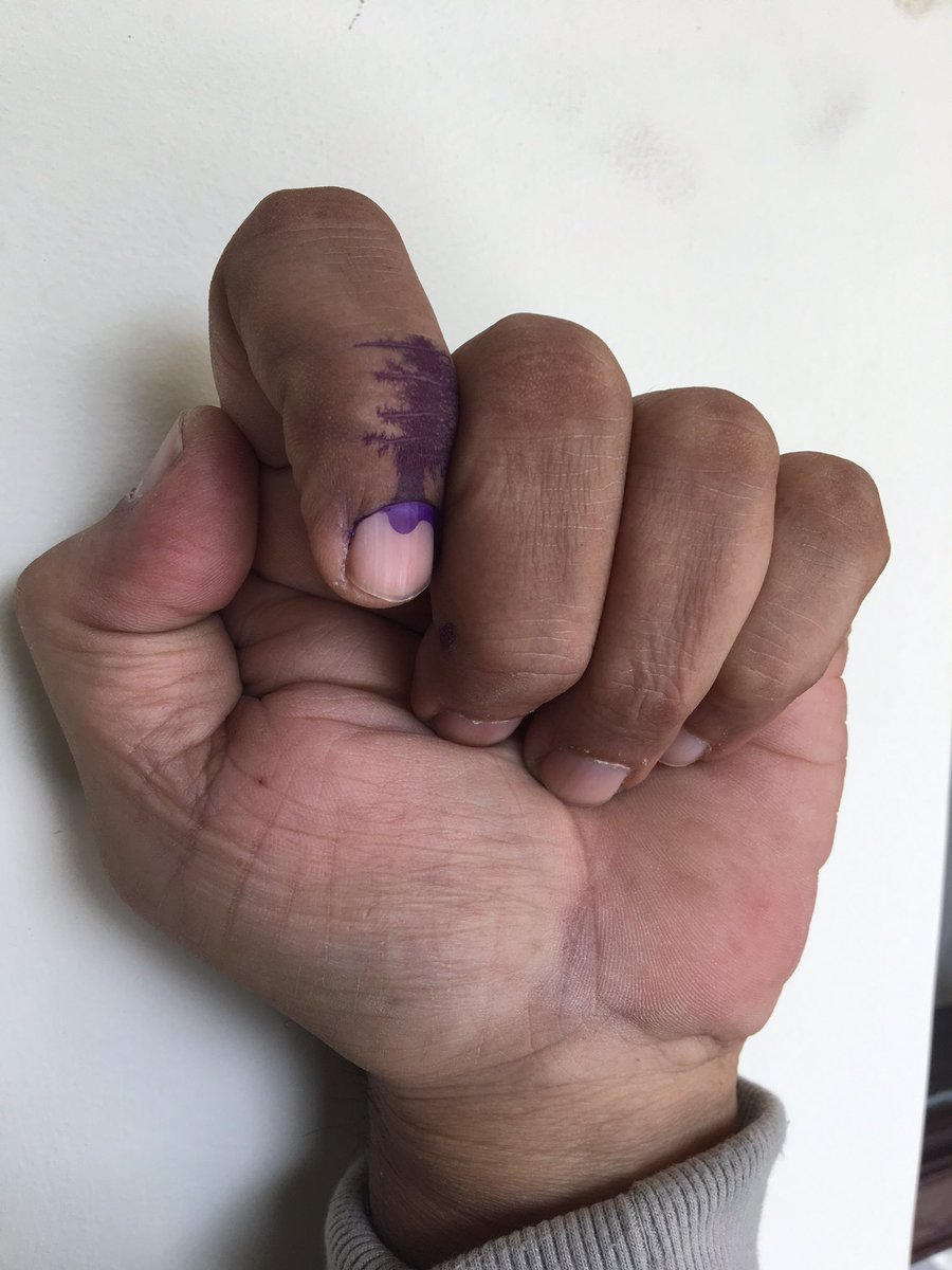 ColSanjayPande's tweet photo. 2.  #CanTheDeadVote ? #DeadCanVote #DeadVoter Can the dead vote? @BJP4India @AamAadmiParty @INCIndia Please answer. No theoretical answers. Death Registration records are available. Voter Card details hence available. What stops mass voting by proxy’s? By illegal immigrants? https://t.co/rDfCK0Uzyr