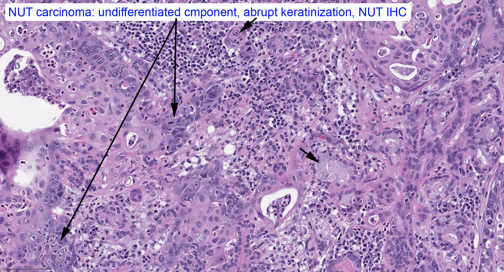 Bin Xu on Twitter "https//t.co/ehVcI0C5Kg" / Twitter