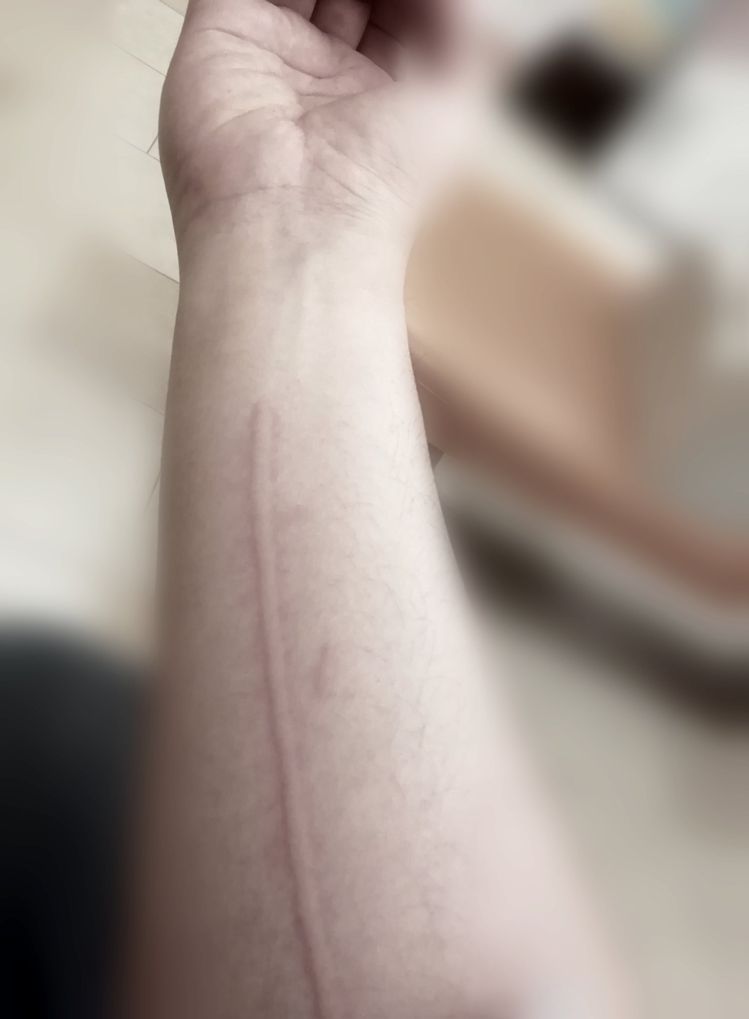 تويتر よんてんごp على تويتر ﾜｲ 蕁麻疹がひどい 病院で見てもらおう 医者 なるほど ちっと指で引っ掻いてみるわ ﾜｲ 引っ掻くだけで発症するんか ﾊﾞﾊﾞｰｰｰﾝ ﾜｲ やばい 医者 やばい T Co 6q1jwrjtcd