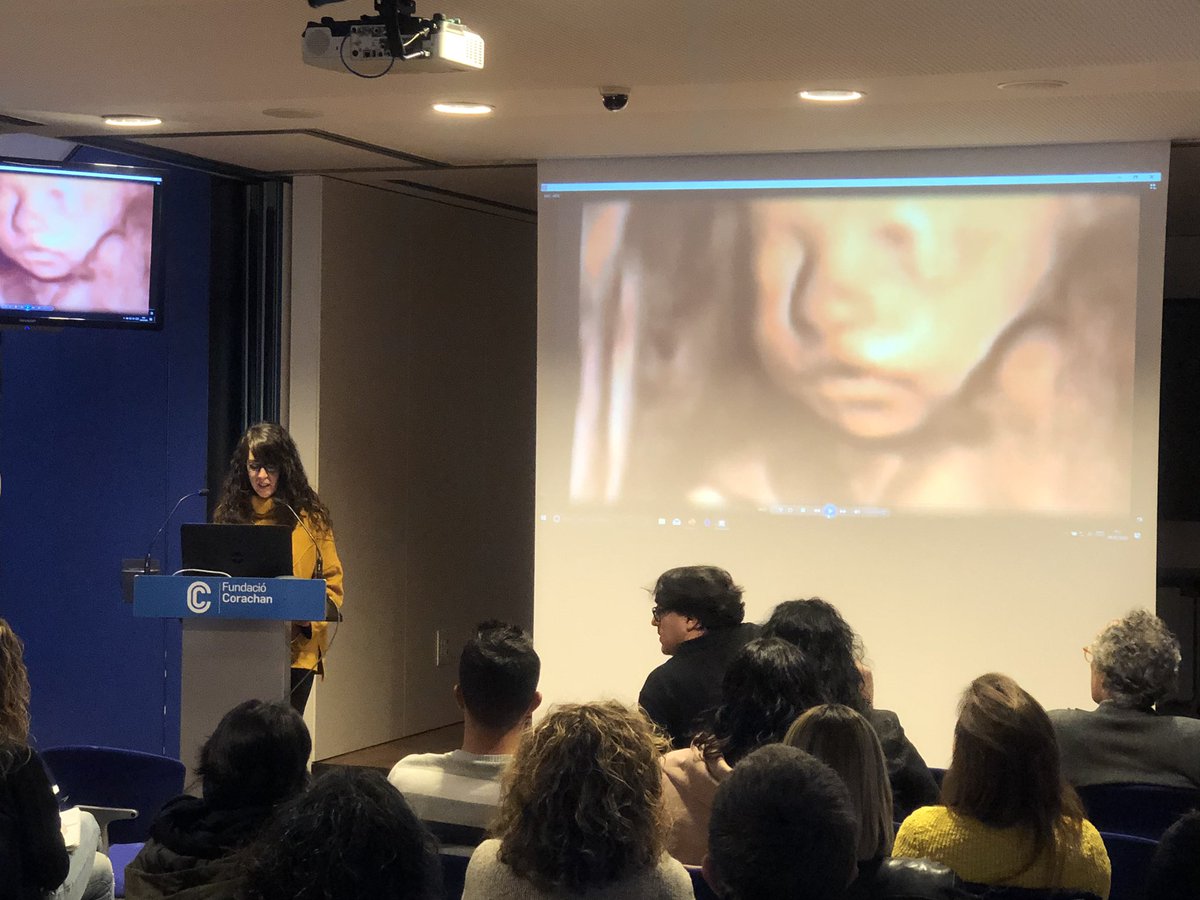 Genial inicio de la I  jornada de #epilepsia en <a href="/ClinicaCorachan/">Clínica Corachan</a>. Presentando <a href="/AAledo/">tony_661</a> y <a href="/apoyodravet/">ApoyoDravet</a>.
#conocelaepilepsia
<a href="/fedeepilepsia/">Fedeepilepsia</a> <a href="/mar_de_somnis/">Mar de Somnis</a>