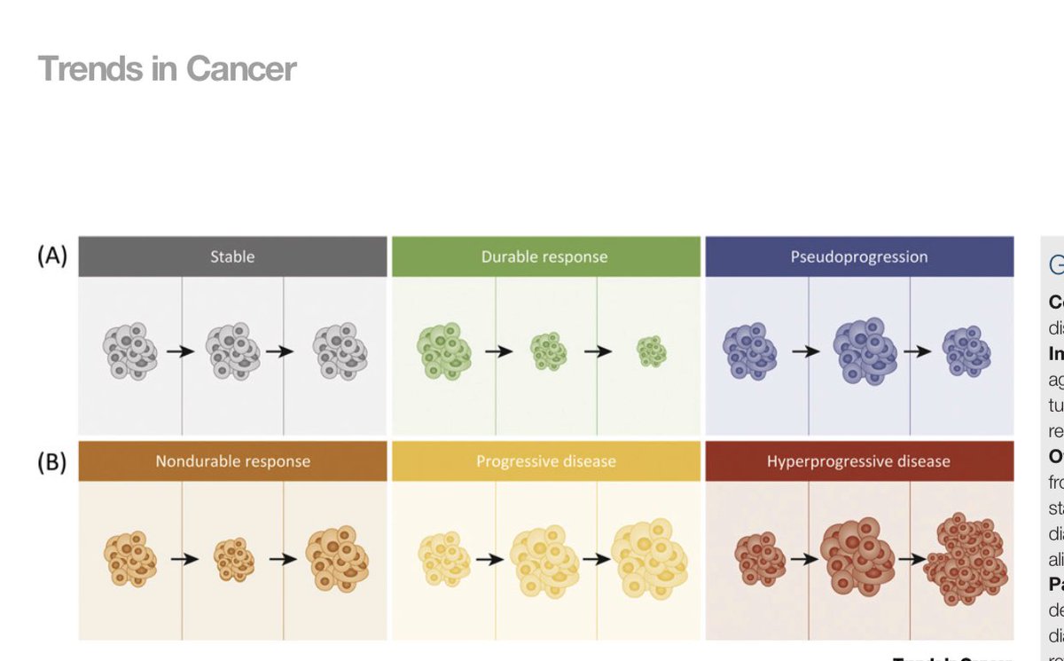 VivekSubbiah's tweet photo. Weekend reading ➡️Quite the debate 👉🏼HYPER PROGRESSION & #IMMUNOTHERAPY -Fact, Fiction or #alternativefact ? Just in time for @ASCO @sitcancer #ImmunoOnc20 @trendscancer @CellCellPress This phenomenon has polarized oncologists ! https://t.co/eOpBjqADhN https://t.co/UusER2i61q