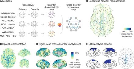 Shared vulnerability for connectome alterations investigated in ~900 patients and ~1000 controls across 12 neurological &amp; psychiatric diagnoses:

Connections central to the brain’s infrastructure are disproportionally involved in a wide range of disorders

buff.ly/2OA2MvT