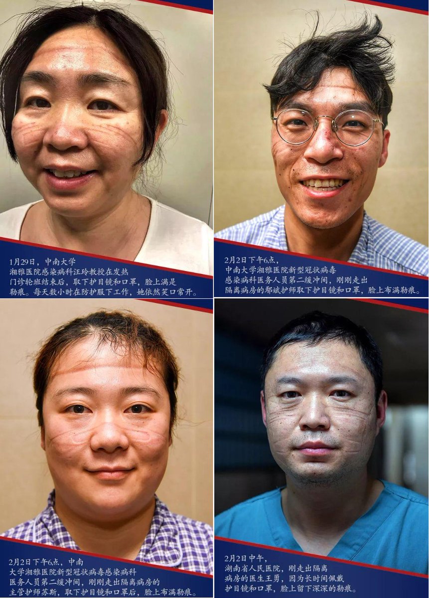 AndyBiotech's tweet image. JAMA paper basically corroborates the depressing stat that &amp;gt;500 healthcare workers been infected by #coronavirus in #Wuhan alone


My heart goes out to all these heroes who put their lives at risk fighting at frontline! Remember these angels&apos; marks! 🙏🙏🙏