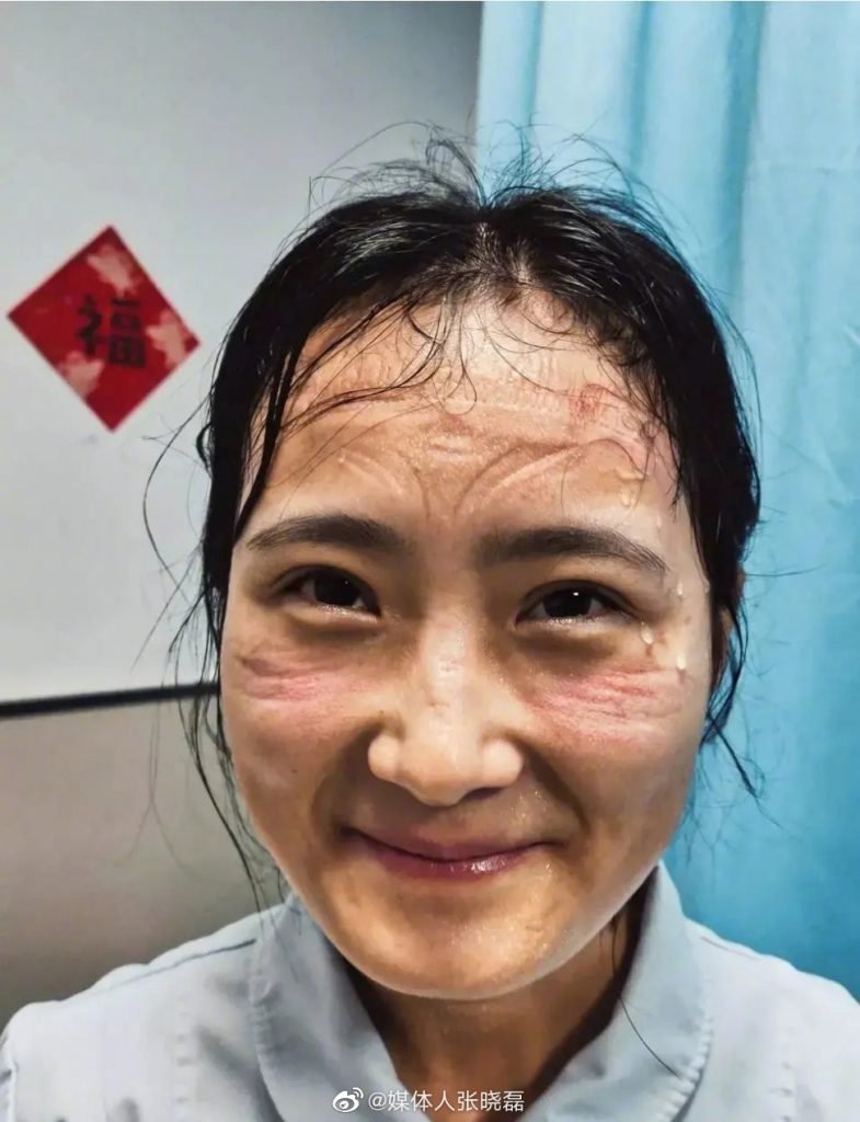 AndyBiotech's tweet image. JAMA paper basically corroborates the depressing stat that &amp;gt;500 healthcare workers been infected by #coronavirus in #Wuhan alone


My heart goes out to all these heroes who put their lives at risk fighting at frontline! Remember these angels&apos; marks! 🙏🙏🙏