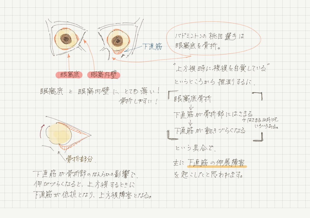 眼窩 底 骨折 と は