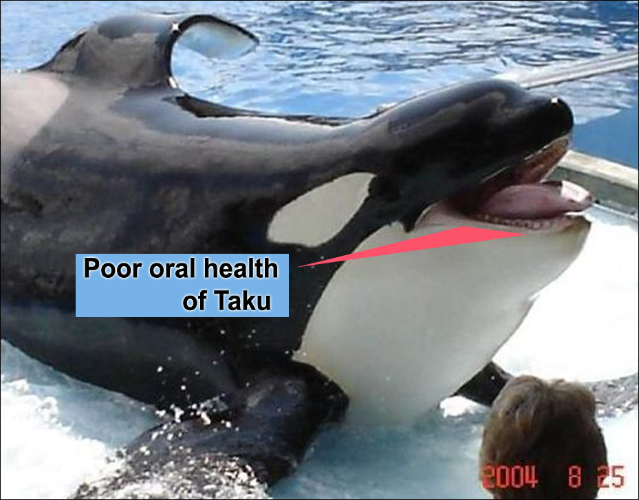 Voice_OT_Orcas's tweet photo. Taku, in Orlando, with a diseased mouth, 2004. He impregnated his mom around the same time this photo was taken. Their inbred calf Nalani was born 2006 (18 mos gestation). Taku was shipped 2 Texas after this, dying of neuroinvasive West Nile Virus, 2007 #CaptivityKills #Blackfish https://t.co/bx21uRr98X