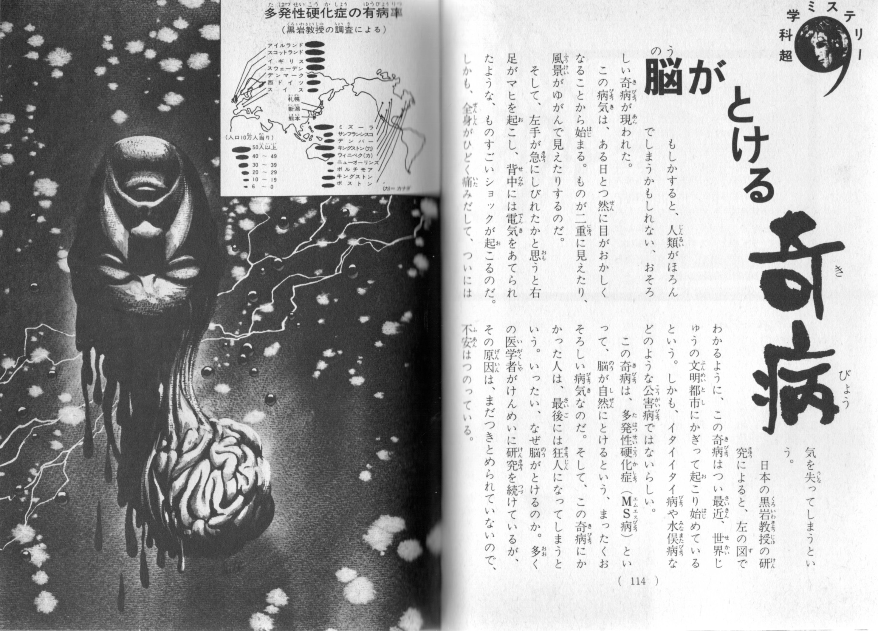 K Hisadome 絵ときこわい話 怪奇ミステリー で最大のインパクトを有した記事は 多発性硬化症 Ms を紹介した 脳がとける奇病 このおどろおどろしいイラストと相俟って 当時の少年少女を恐怖のどん底に突き落としたのでした T Co