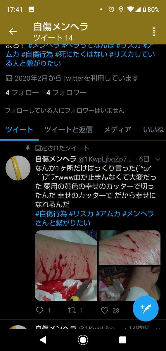 自傷メンヘラ そうこのアカウントの人だよ全部消えた私のデータ私だけなんで消されるのふざけるな 自傷行為 リスカ メンヘラ Od 凍結された 自傷メンヘラ そうこのアカウントの人だよ全部消えた私のデータ私だけなんで消されるのふざけるな 自傷行為 リスカ メンヘラ Od 凍結された