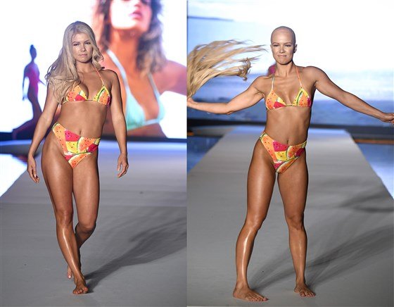 Sports Illustrated model with alopecia pulls off her wig on the runway'

alopeciaworld.com/profiles/blogs…