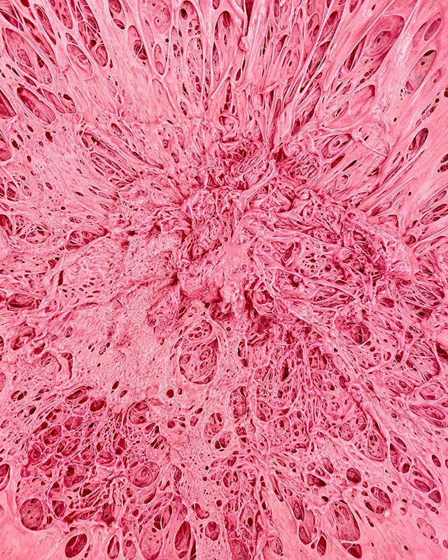 simonejordi's tweet photo. pink Buns in the making💕 #pinkdough #pinkbuns #pinkburger #veganburgers #foodart #foodie #vegan https://t.co/d3VD4yPBRw https://t.co/YsWvHc6zxL