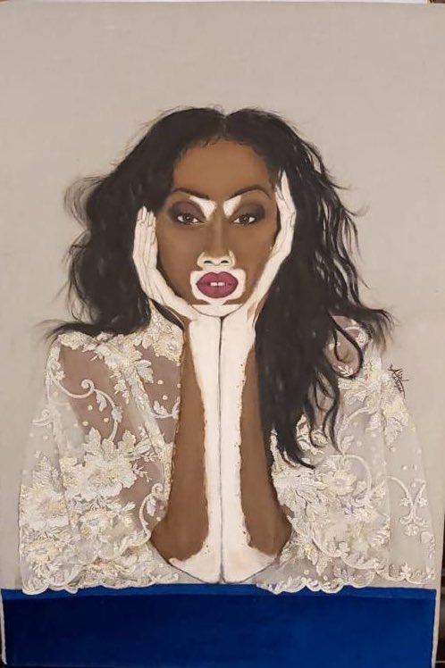 oushyy1's tweet photo. Embrace your beauty.. inspire only by being unique and different.. don’t be afraid of standing out ..because when you do .. you shine ❤️ @alia_nagui @AliaNagui @winnieharlow @winnieharlow #winnieharlow #winnie_harlow https://t.co/iaQG5vzh5L