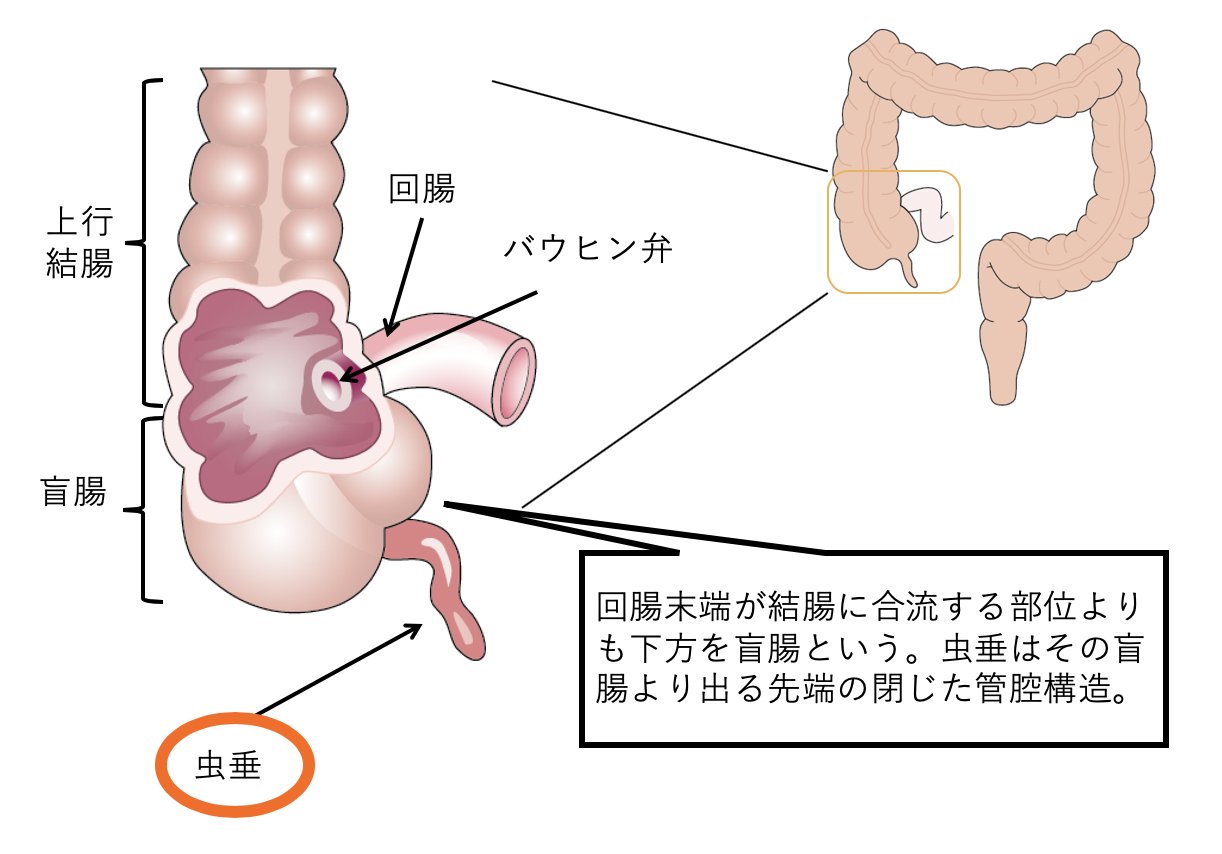 妊婦 盲腸