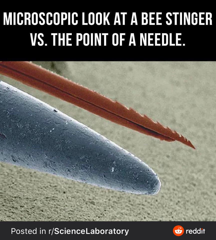 dailygadi's tweet image. Thoughts?

#ScienceLaboratory #beestinger #needle #point #pain #dailygadi