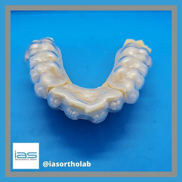 A great looking fixed Gemini case today from Simon! It's going to achieve a stunning result

#fixedbraces #fixed #Gemini #brackets #teeth #aligning #traintracks #smile #happyteeth #happypatient #3m #dentistry #orthodontics ift.tt/2V2GTth