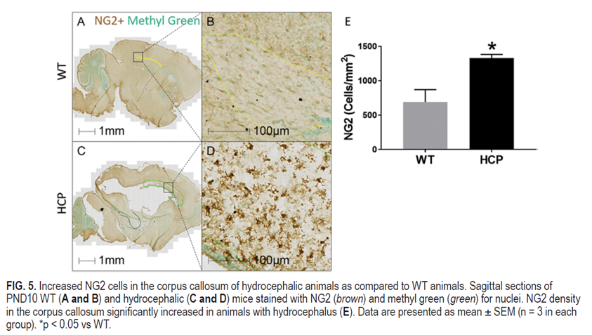 J Neurosurgery Pa Twitter Onlinefirst Neonatal Hydrocephalus Leads To White Matter Neuroinflammation Injury In Corpus Callosum Of Ccdc39 Hydrocephalic Mice Immunohistochemistry Measures Macrophage Activation In White Matter In Mice With