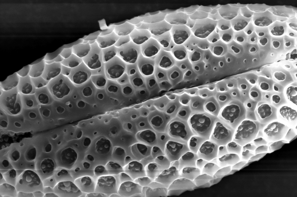 sneezeproject1's tweet photo. Do you suffer from #hayfever❓Here is a #microscopic view of your enemy❗️
-
@ace_national #pollen #art #pollencount #allergy #treepollen #trees #plantreproduction #asthmauk #pollenators #scienceart #pollenallergy #pollensucks #artscience #artsforhealth #pollennation https://t.co/6eI1kN5Nzt