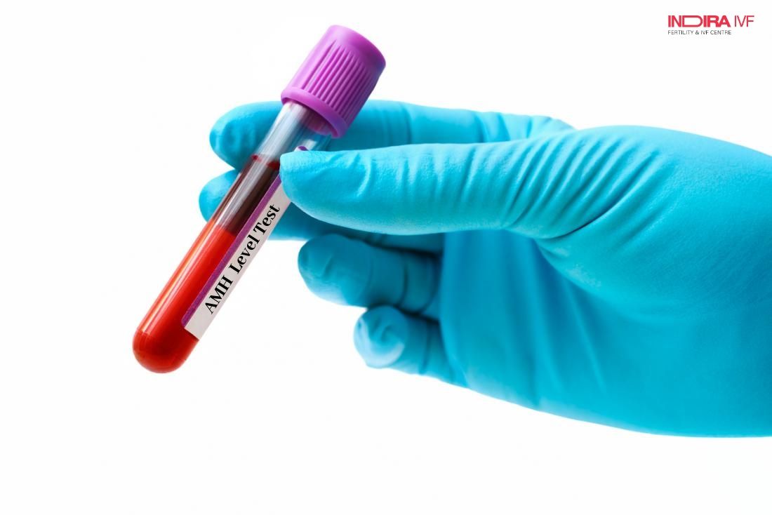 RiyaJos49743529's tweet image. Is AMH level test 100% reliable? apsense.com/article/is-amh…
.
.
.
.
#AMHLevelTest #AMHTest #LowAMHLevels #FemaleHaelth #LowAMH #womenhealth #AMHTests #HowtoIncreaseAMHLevel #whatisamhtest #India #IndiraIVF #AMHlevelandFertility