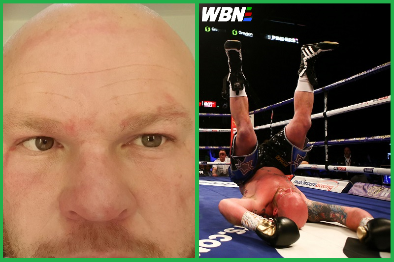 WorldBoxingNews's tweet photo. Dave Allen opponent Dorian Darch comes out swinging on 'fight fix' claims https://t.co/lJGVhox7gN #AllenDarch https://t.co/q3D4cI0ib1