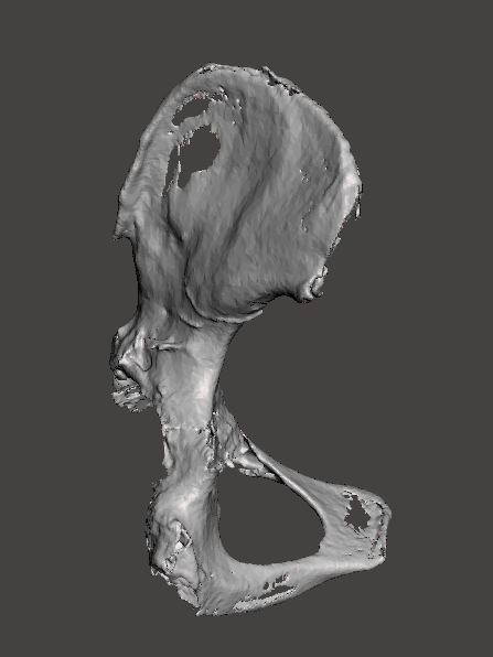 3d_maranon's tweet photo. 3D printed model of a hemipelvis with bone deficiency used for planification and as a starting point for the creation of a hip implant. https://t.co/zvyyi2aYfc