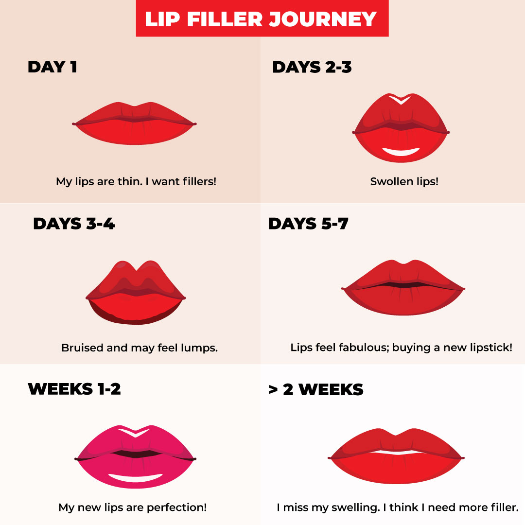 MDLSV's tweet image. Your perfect pout awaits. Take the Lip Filler Journey with us.