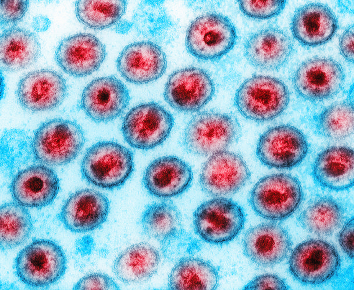 Scientists discovered a mysterious virus in Brazil, #Yaravirus.

90% of the genes have never been found before: cmplx.co/3AFITs3